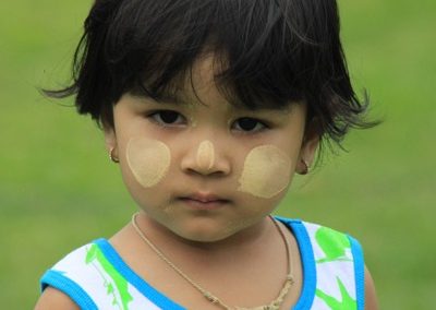 A young girl with yellow spots on her face.